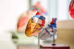 Soft Tissue Injury Car Accident in Huntington Beach