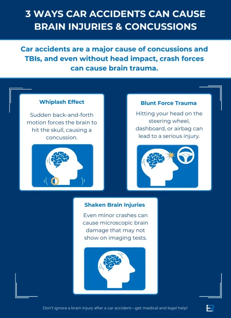 Infographic about ways car accidents can cause brain injuries and concussions