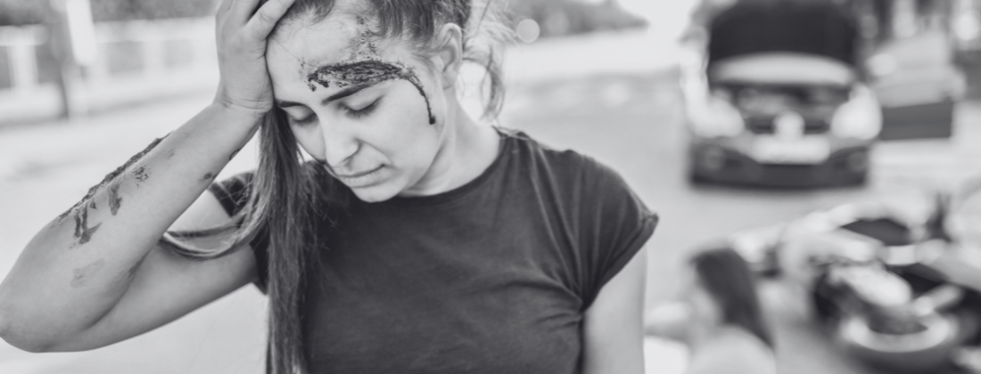 How to Treat Road Rash From a Motorcycle Accident